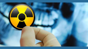 Clicca per accedere all'articolo ODONTOIATRI E OBBLIGO FORMATIVO IN MATERIA DI RADIOPROTEZIONE